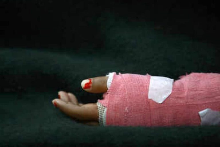 2 Contract Workers Suffer Severe Burns After Liquid Metal Spills on Them at Steel Plant in Visakhapatnam