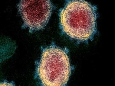 New double mutant variant of SARS-CoV-2 found in 18 states, says Health Ministry