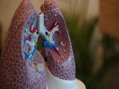 IIT Kharagpur model predicts SARS-CoV-2 alters lung cell metabolism post infection