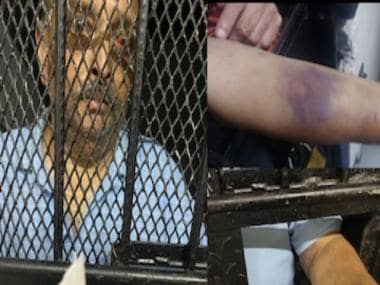 Mehul Choksi’ photos from Dominica released by local media; PNB scam accused seen with swollen eye, bruised arm