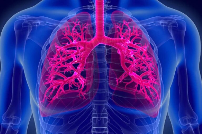 Decoding Long Covid: A Pulmonologist Explains Effects on Lung Health And Oxygen Requirements After Recovery