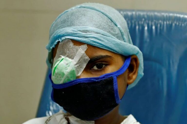 Andhra Reports 153 New Black Fungus Cases in Last Five Days