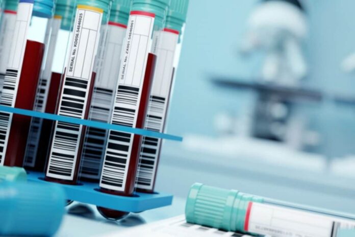Mumbai Reports First Death Due to Delta Plus Variant as 63-yr-old Fully Vaccinated Woman Succumbs