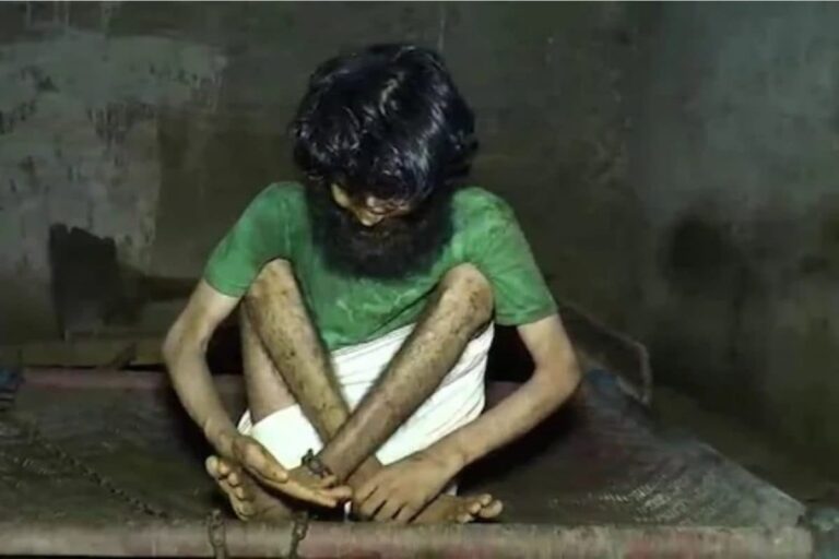 Mentally Challenged Haryana Youth Chained For a Decade Rescued By NGO