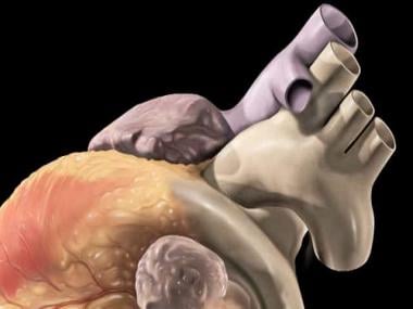 Why it is important than ever to care for your heart till COVID-19 is around