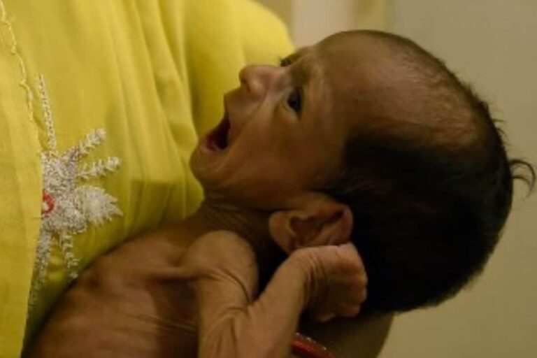 Young Children’s Diets Show No Improvement in Last Decade, Could Get Worse’ Under Covid: UNICEF