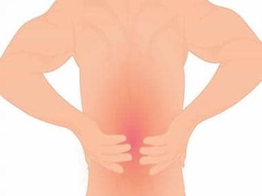Back pain: From causes and treatment to minimally invasive surgery, what you need to know