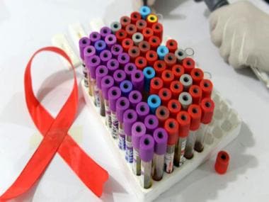 World AIDS Day 2021: All you need to know about vaccines for HIV and their development