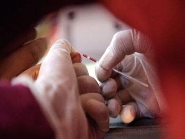 World AIDS Day 2021: Remembering the HIV epidemic in times of coronavirus