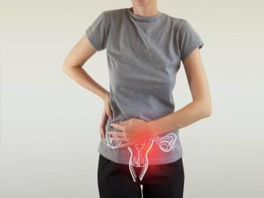  Cervical Cancer Screening: What women should know?