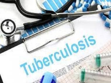 Russia-Ukraine conflict poses a threat to the control of drug-resistant TB in the world