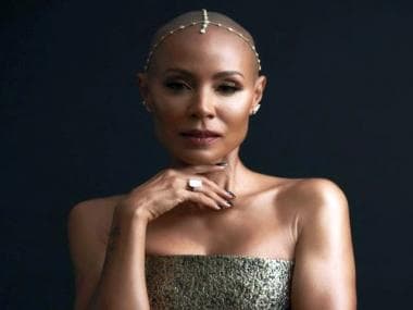 Alopecia Areata: The autoimmune condition that Will Smith’s wife Jada Pinkett Smith suffers from