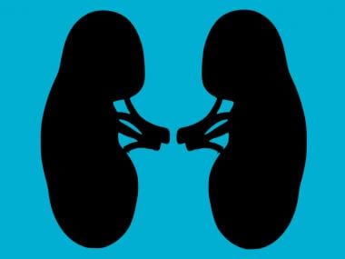 World Kidney Day: Simple exercises kidney patients should put in their healthy routine