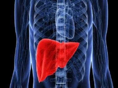 World Liver Day 2022: Diet dos and don’ts to maintain a healthy liver