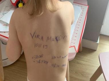 Heartbreaking! Ukrainian mother writes family contact information on her daughter’s body