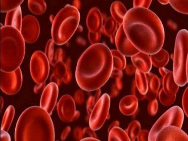 World Thalassemia Day: Things parents of thalassemic children must know