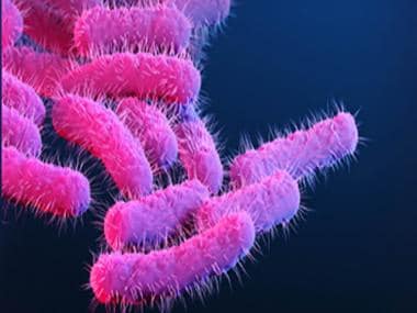 Explained: What is Shigella, the bacteria that killed Kerala girl after eating shawarma?