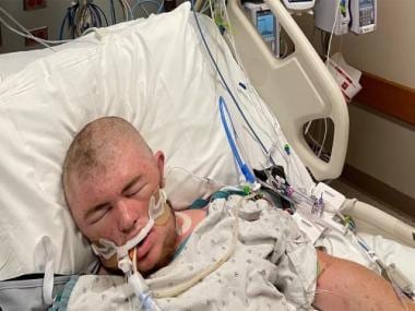 Ohio man escapes death after getting stung ‘20,000 times’ by bees