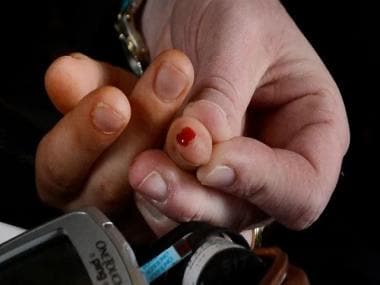 Diabetes: What are natural ways of reversing it