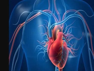 Former athletes face increased risk of high blood pressure and heart attack