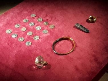 UK: Treasure hunters fines 1.2 million euro for selling 1100-year old Anglo-Saxon valuables