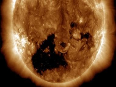 Solar danger: Giant hole 20X larger than the Earth seen on the Sun, second such hole to appear in a month